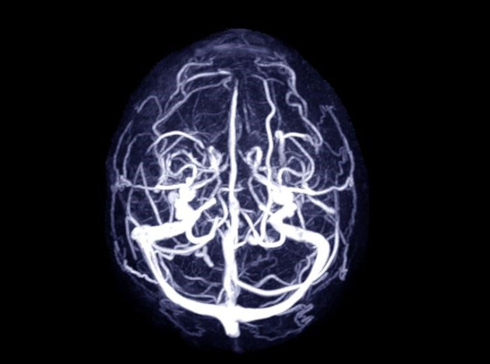 نوبت دهی ام آر وی یا ام آر ونوگرافی