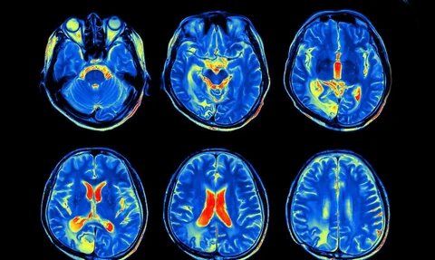 نوبت دهی ام آر آنژیوگرافی ، چرایی و کاربردهای آن