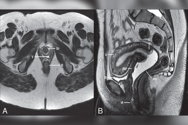 نوبت دهی ام آر آی رحم و اطلاعات آن