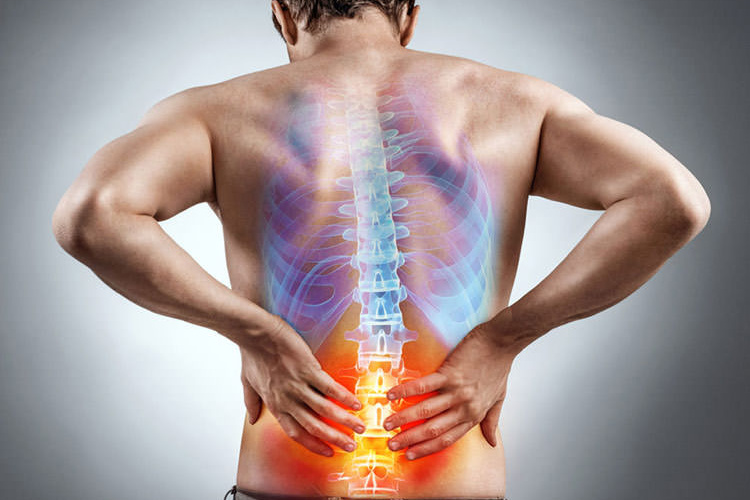 نشانه و درمان کمردرد شدید چیست ؟